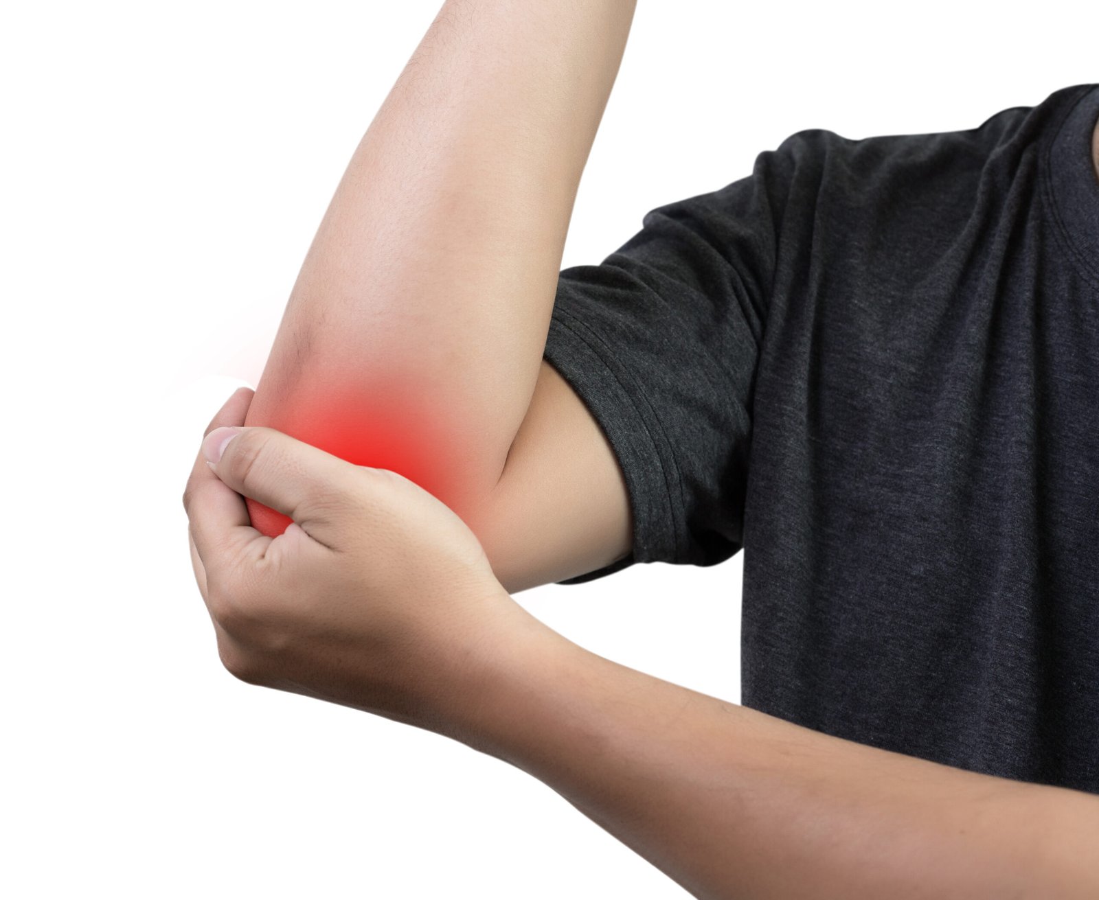 Radial Head Fracture