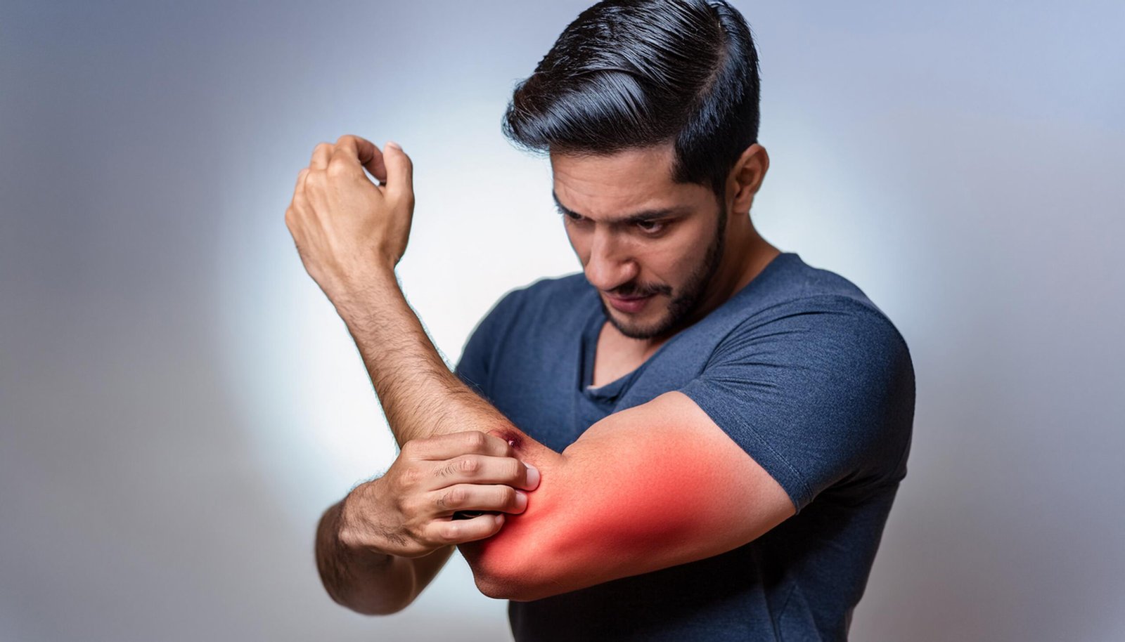 Proximal Biceps Rupture